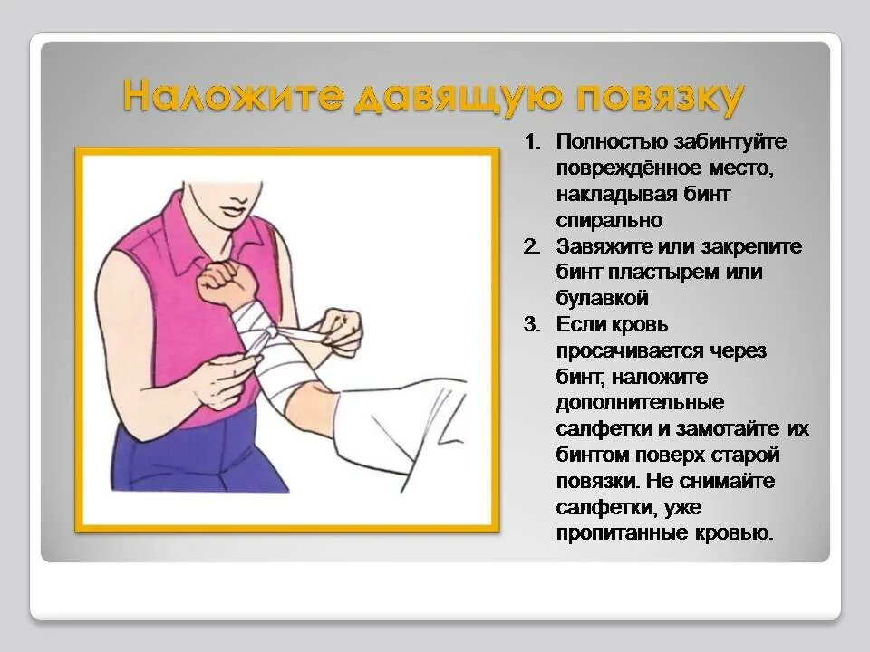 Первая помощь при кровотечениях 8 класс обж. Наложить давящую повязку. Наложение давящей повязки на руку. Давашач повязка на руку. Давящие повязк ана руку.