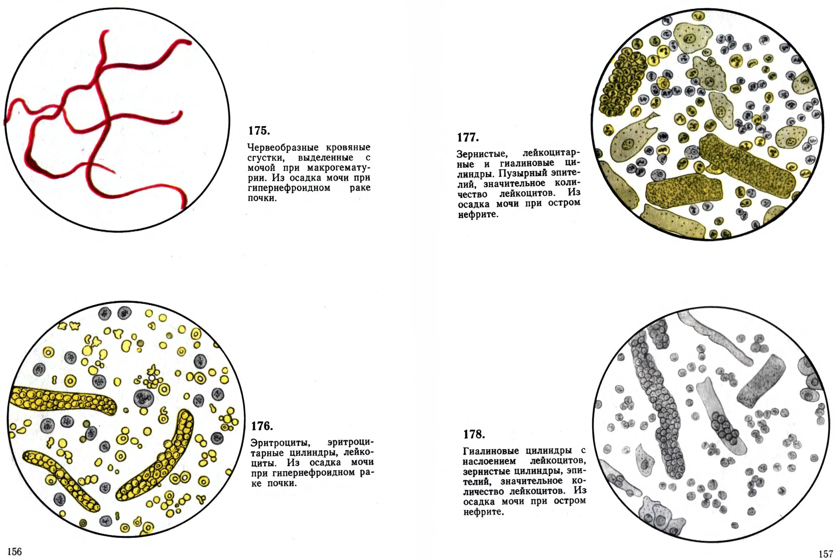 Микроскопия осадка мочи атлас. Мочевой атлас микроскопии осадков мочи. Краевский атлас микроскопии осадков мочи. Краевский атлас микроскопии осадков мочи книга.
