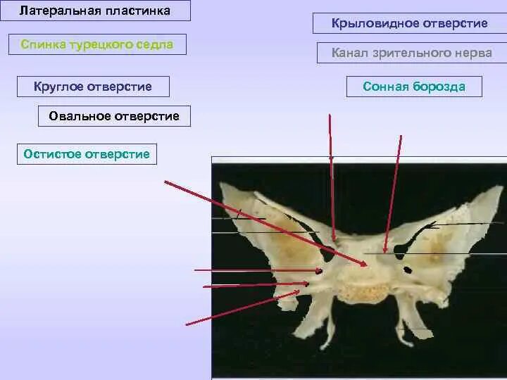 Спинка турецкого седла. Клиновидная кость сонная борозда. клиновидная кость турецкое седло. клиновидная кость спинка седла. гипофизарная ямка турецкого седла клиновидной кости.