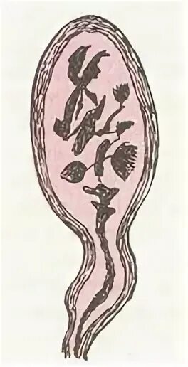 колбы краузе и тельца руффини.