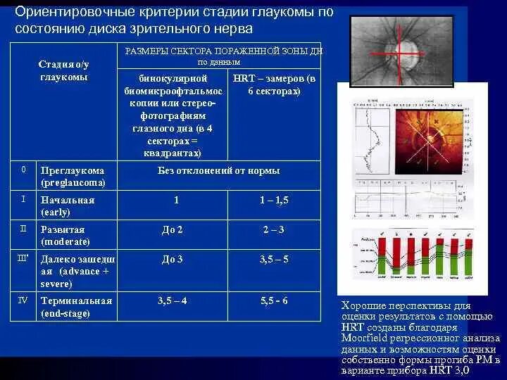 Размеры зрительных нервов. Диаметр диска зрительного нерва в норме. Диск зрительного нерва HRT. Размеры диска зрительного нерва. Окт ДЗН при глаукоме показатели.