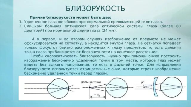 Глаз имеет оптическую силу. Оптическая система глаза. Преломляющая сила оптической системы глаза. Удлиненное глазное яблоко при близорукости. Оптическая сила при близорукости.