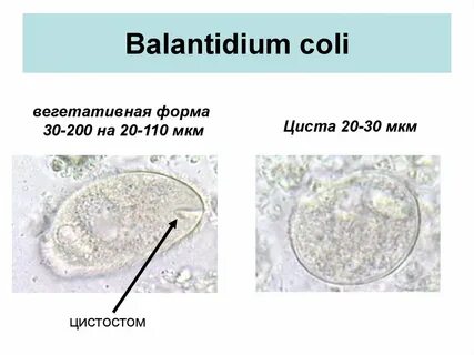 Циста бактерий