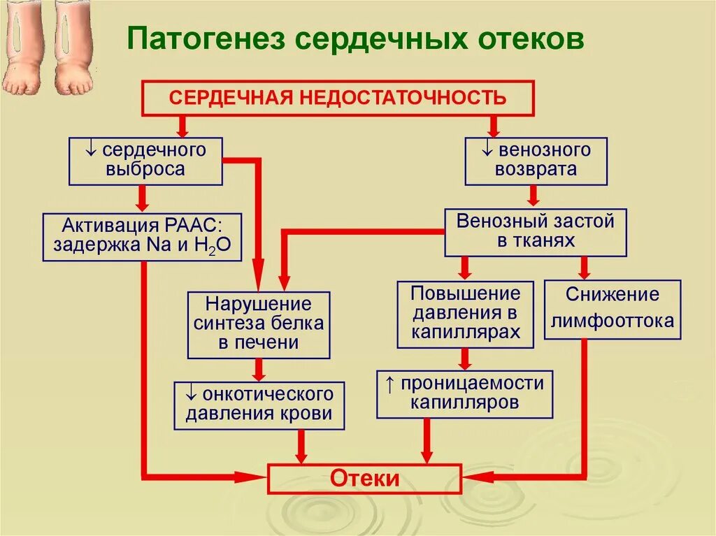 Отеки сердечного происхождения. Отек сердечного происхождения тест. Отеки при заболеваниях сердечно-сосудистой системы. Характерными признаками отёков почечного происхождения. Характеристика отеков при хсн.