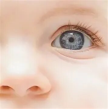 Массаж глаз слезного канала. Дакриоцистит массаж слезного канала у новорожденных. Дакриоцистит массаж слезного канала. Заболевание слезного аппарата дакриоцистит. Дакриоцистит новорожденных массаж слезного канала у новорожденных.