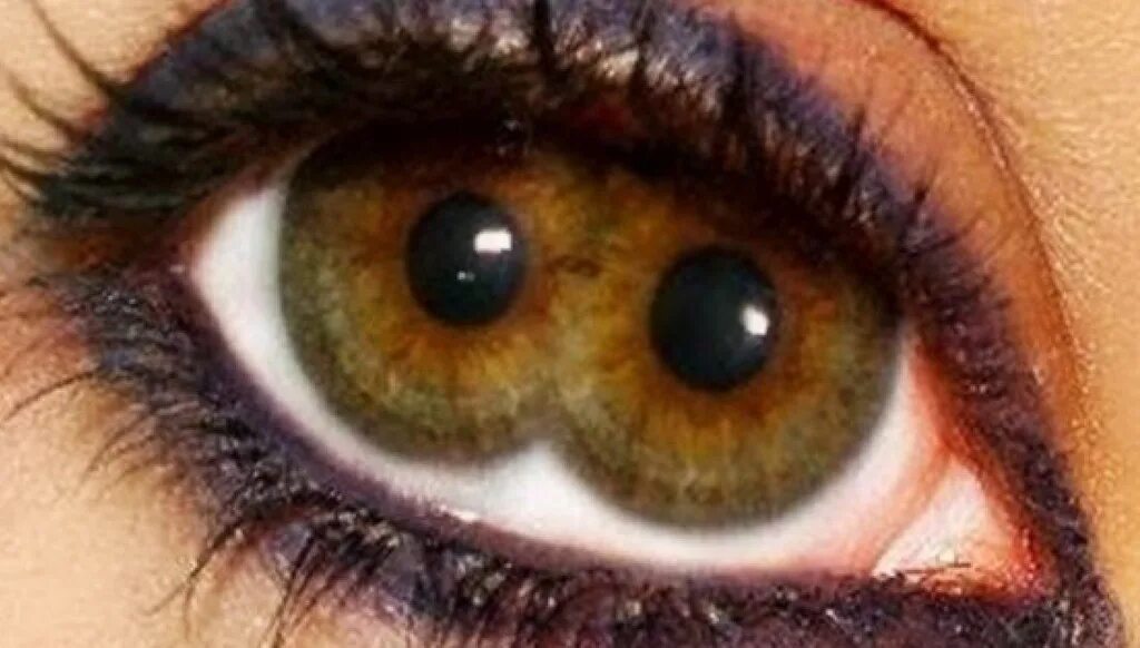 Глаза 1 4. Глаза зрение. Центральная гетерохромия карих глаз. Глаза 1 4. Ирис радужная оболочка глаза.