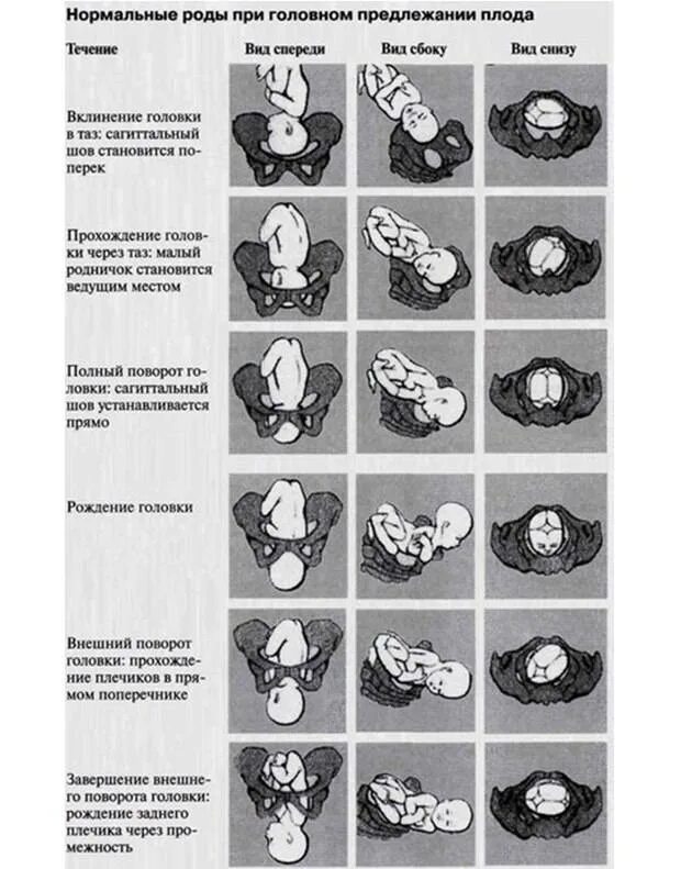 Положения головки плода. Механизм родов при переднем виде головного предлежания. Передний вид затылочного предлежания биомеханизм родов. Задний вид затылочного предлежания биомеханизм родов. Биомеханизм родов при тазовом предлежании кратко.