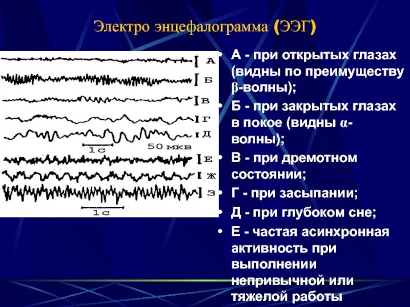 Ээг ребенку 3 года. РЭГ И ЭЭГ. Энцефалография (ЭЭГ). ЭЭГ волны. ЭЭГ при движении.