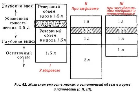 Резервная емкость вдоха