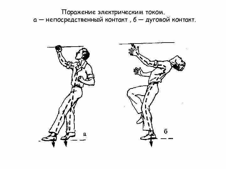 Варианты поражения током. Поражение электрическим током. Дуговой контакт с током. Что такое дуговое поражение Эл током.