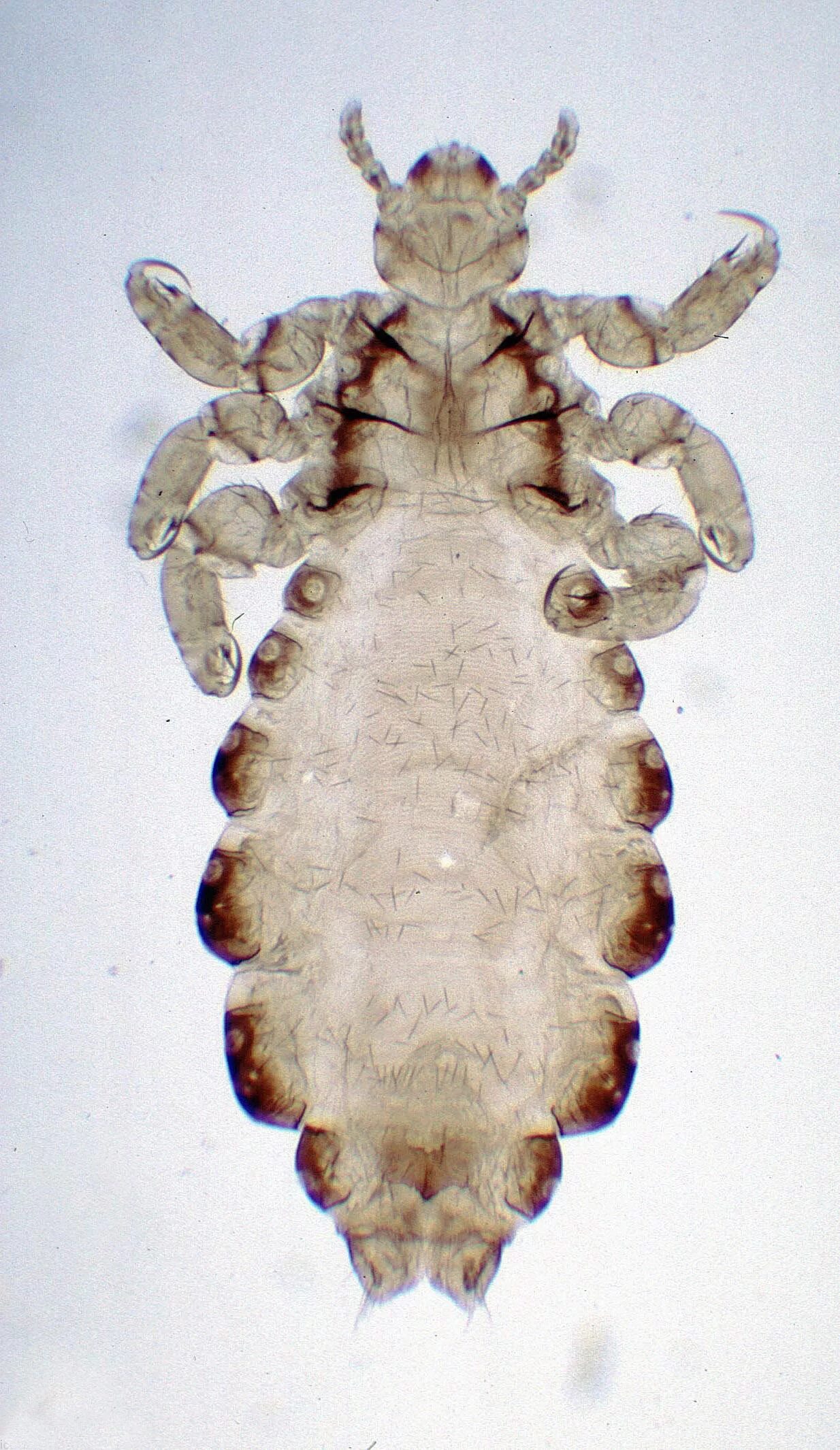 Головная вошь. Вошь Pediculus humanus. Платяная вошь Pediculus humanus. Pediculus humanus humanus строение.