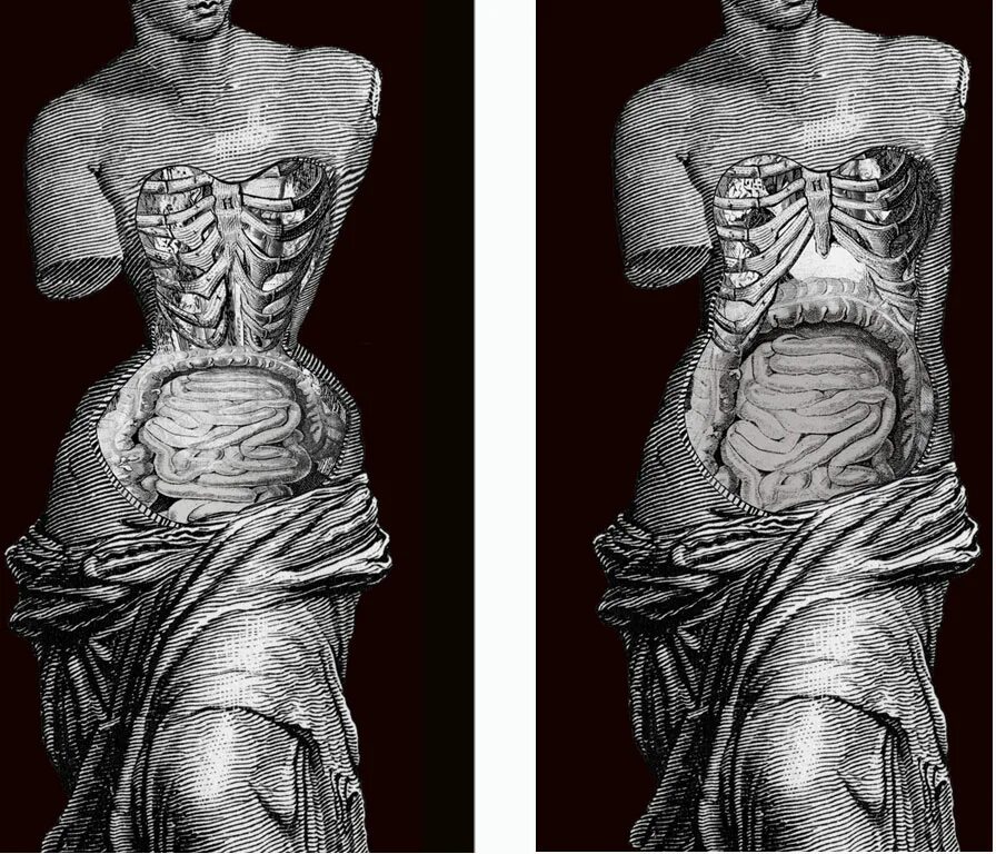 Корсет внутренние органы. Влияние корсета на внутренние органы. последствия ношения корсета. человеческий организм с корсетом. внутренние органы после корсета.
