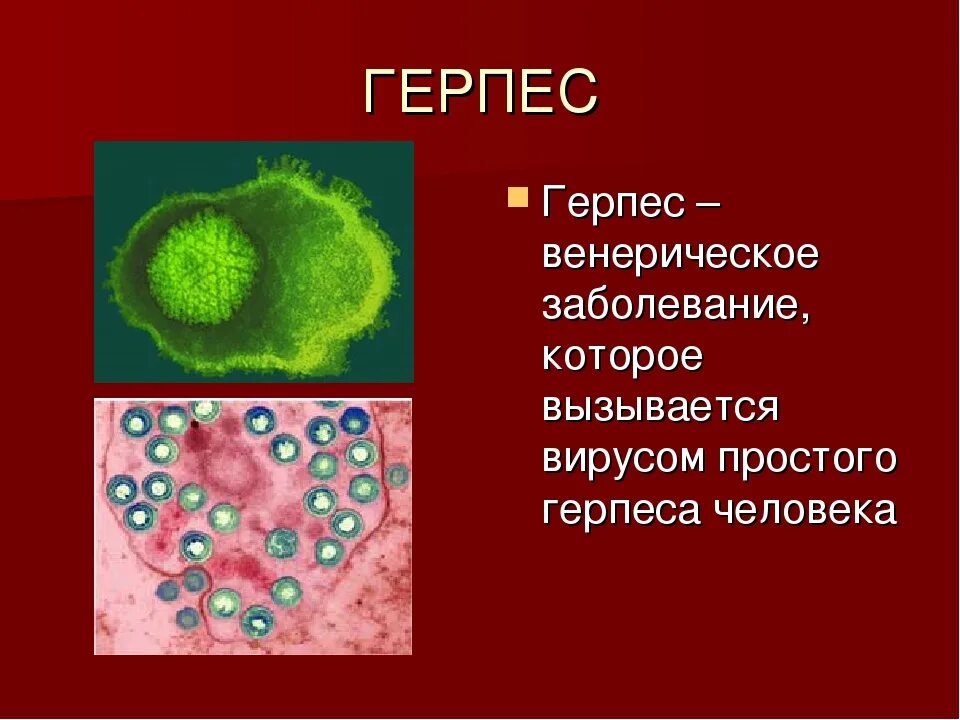 Инфекция половых путей у мужчин. Инфекции половых путей. Винирические заболевание. Венерические щаболевани. Вхинирхические заболевания.