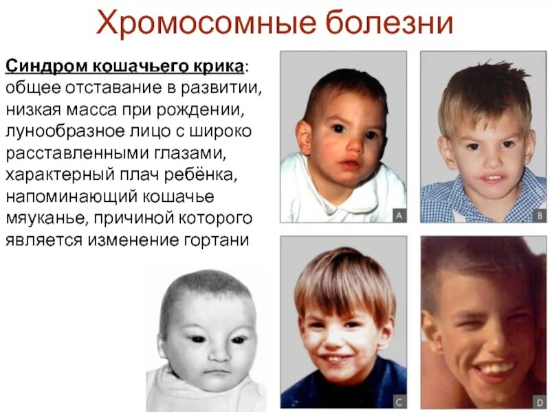 Кошачья болезнь у детей