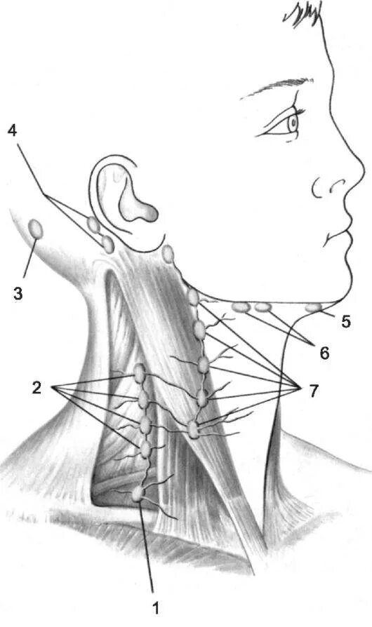 Лимфатический узел челюсть. Шейно надключичные лимфоузлы. Шейные челюстные лимфоузлы. Лимфоузлы угла нижней челюсти. Шейные,подключичные и надключичные лимфоузлы.
