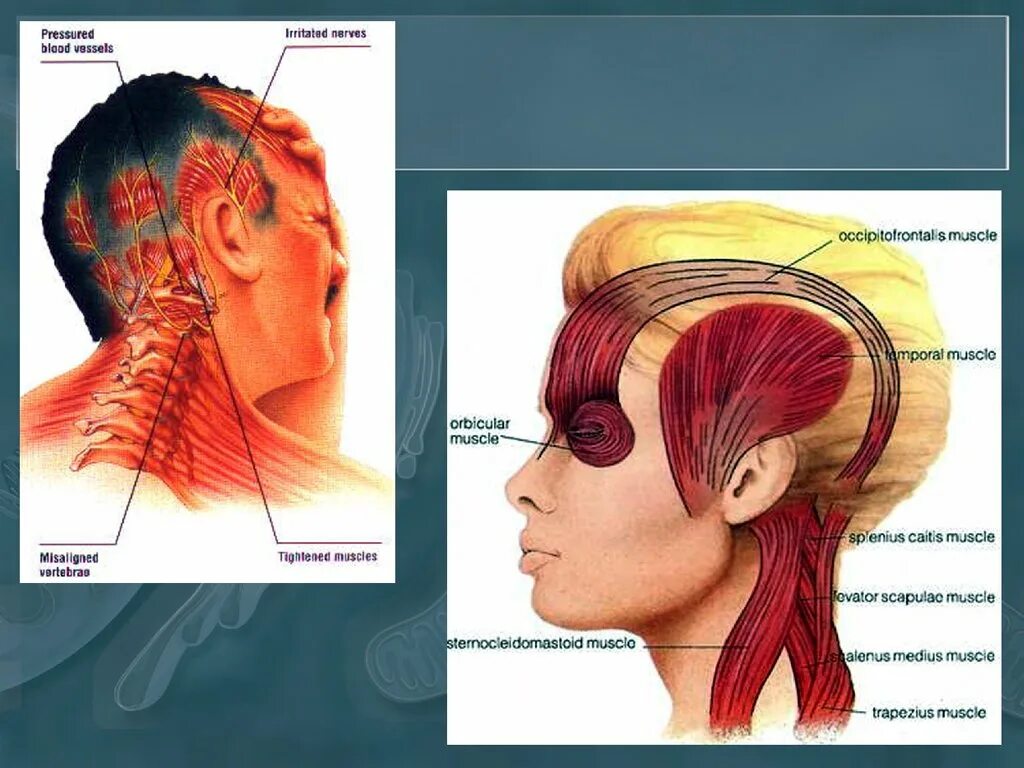 Напряжение в затылке. Головная боль. Головная боль напряжения. Напряжение мышц головы.