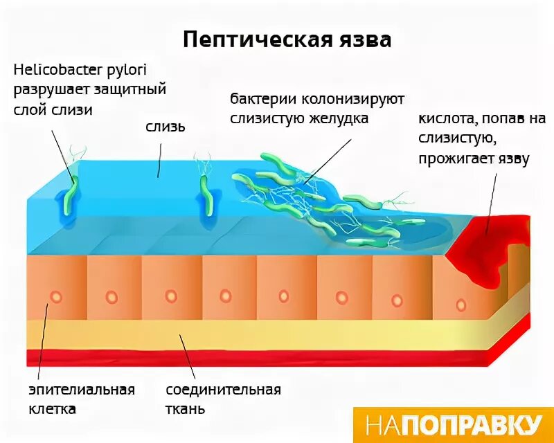 Слизистый барьер желудка. Слизисто-бикарбонатный барьер желудка. Желудок содержимое слизь