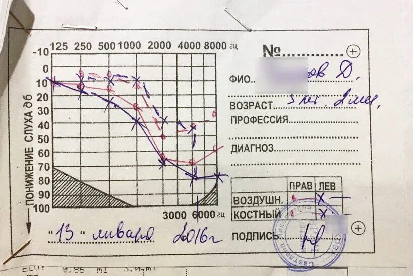 4 степени тяжести тугоухости. Степени потери слуха таблица. Тугоухость 2 степени и 4 степени инвалидность. Слуховой паспорт при нейросенсорной тугоухости 3 степени. Тугоухость 2 3 степени.