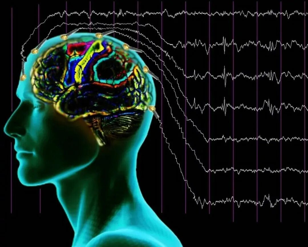 Изменения биоэлектрической активности мозга. Электроэнцефалография (ЭЭГ). Электроэнцефалография электроэнцефалограмма головного мозга. Электроэнцефалография головного мозга (ЭЭГ). Электро осциллограмма головного мозга.