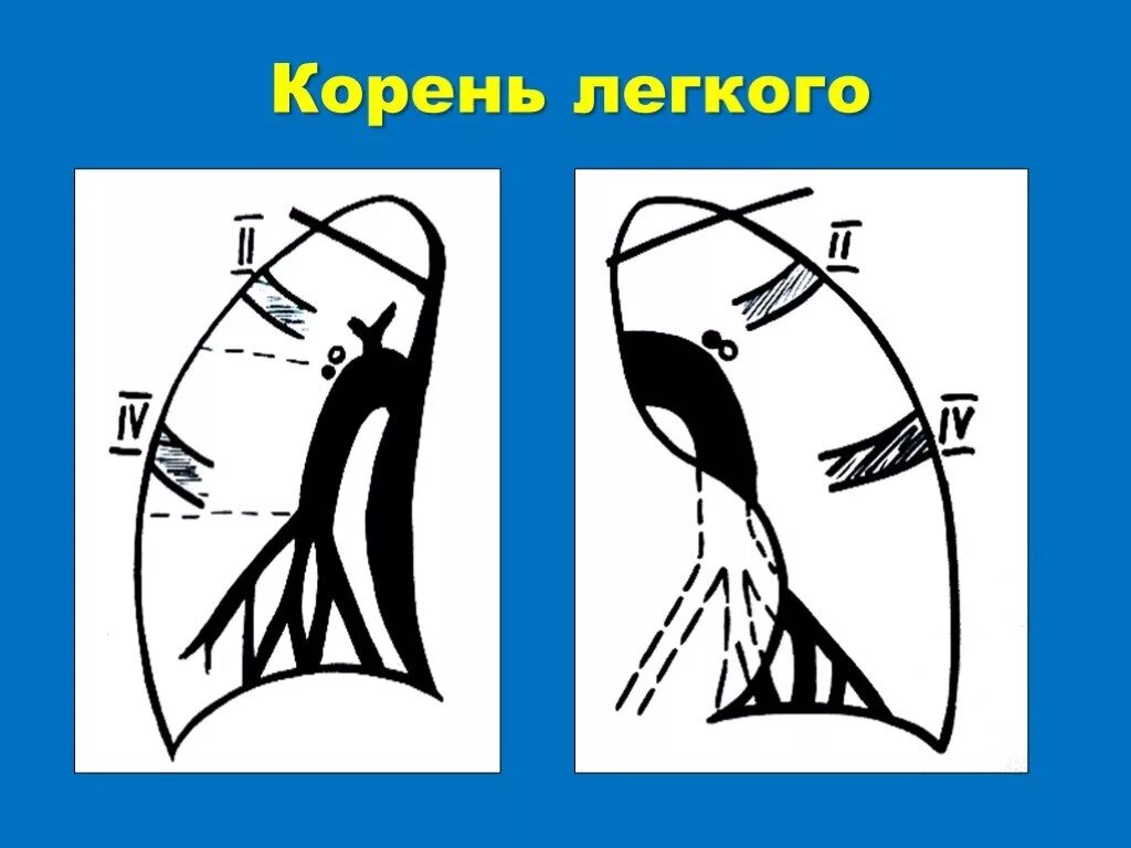 Корень легкого. Корень легкого состоит из.