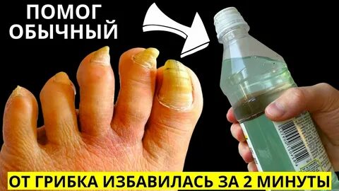 Избавиться от грибка навсегда