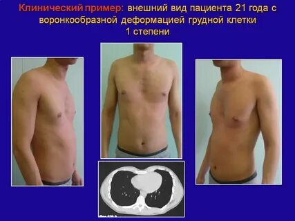 Деформированная форма