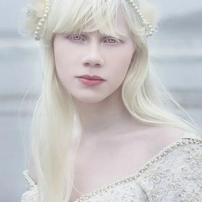 Rosie Crawford альбинос. Лэйни чэнг альбинос. Девушка альбинос. Девушка альбинос красивая.