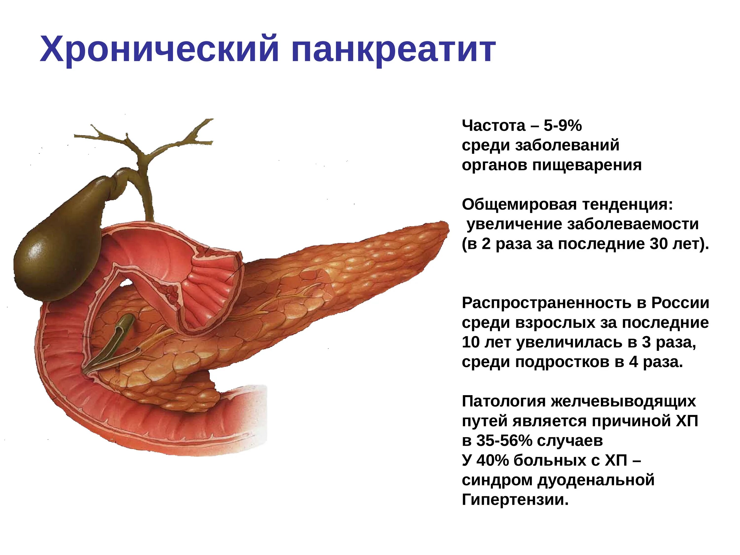 Диффузное увеличение поджелудочной. Болезнь поджелудочной железы панкреатит. Хронический панкреатит поджелудочная железа. Болезнь хронический панкреатит поджелудочной железы. Патология хронического панкреатита.