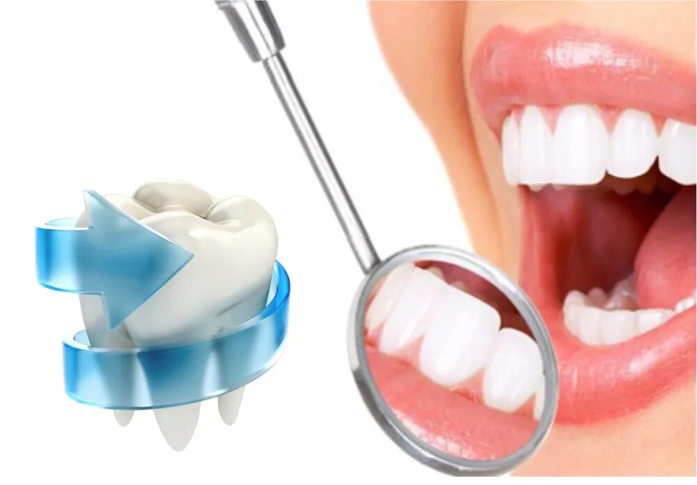 Профгигиена рта нижний новгород. Реминерализующая терапия глубокое фторирование. Фторирование зубов эмали глубокое эмаль. Фторирование зубов фторлак. Глубокое фторирование эмали зуба (1 зуб).