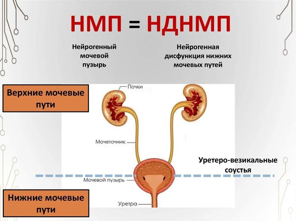 Нейрогенный мочевой пузырь. Нейрогенный мочевой пузыт. Нейрогенный мочевой пузыт рь. Нарушение функции мочевого пузыря. Диффузный мочевой пузырь