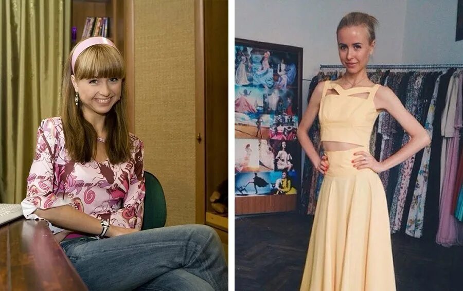 Карпович до и после пластики Вот так похудела Мирослава Карпович! А как вы считаете, это красиво или нет 201