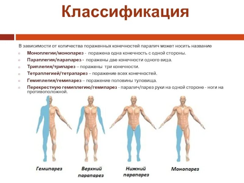 Двигательные нарушения парезы