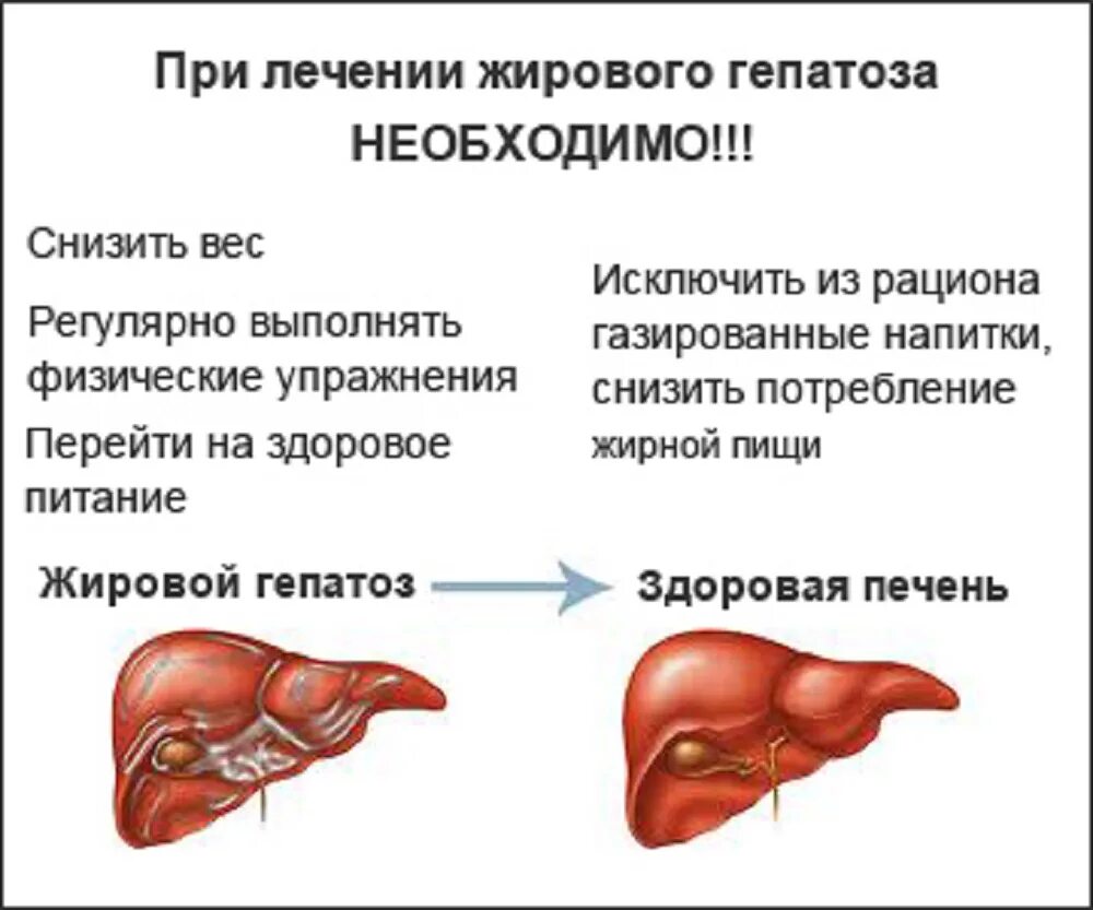 Ли вылечить гепатоз печени