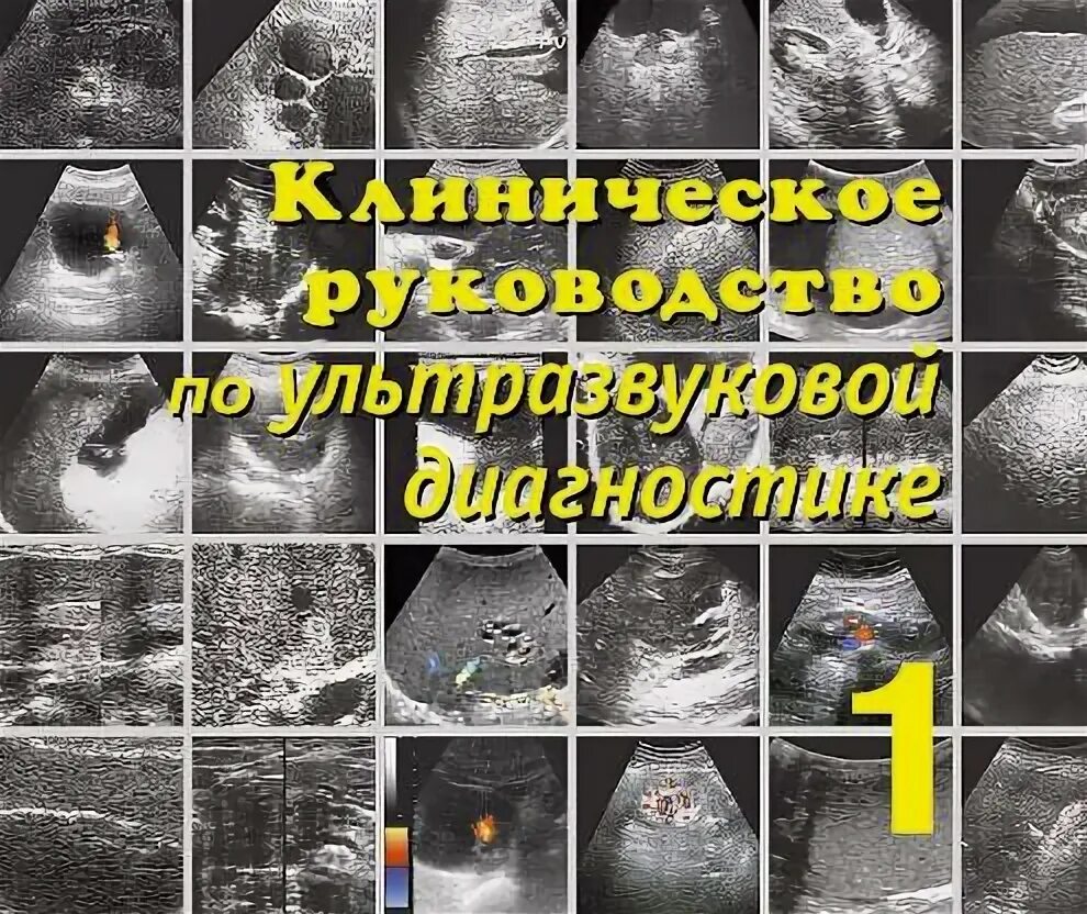 Клиническая руководство по УЗИ Митьков руководство. Митьков ультразвуковая диагностика 5 томов. Практическое руководство по УЗД. Ультразвуковая диагностика книги