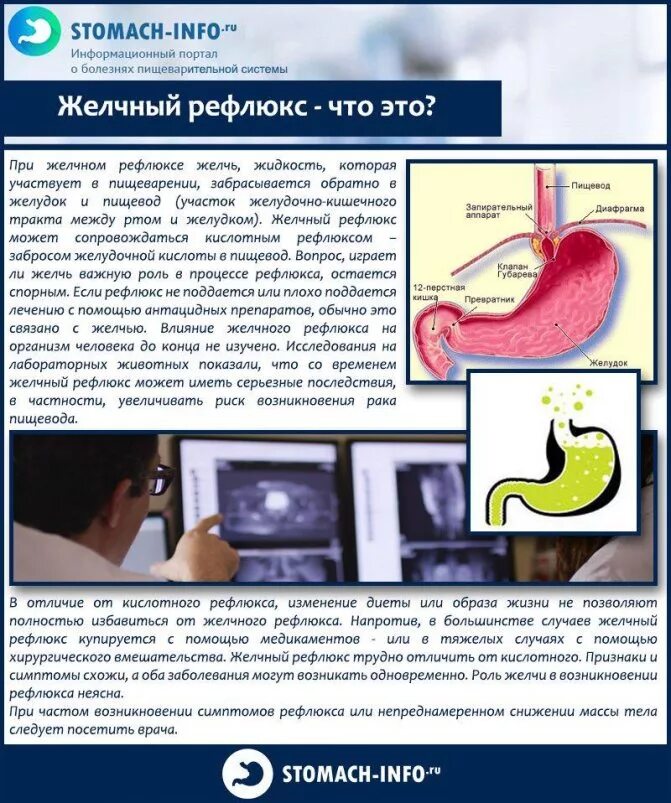 Гастральный рефлюкс желчи. Дуоденальное билиарный рефлюкс. После еды кисло и боли