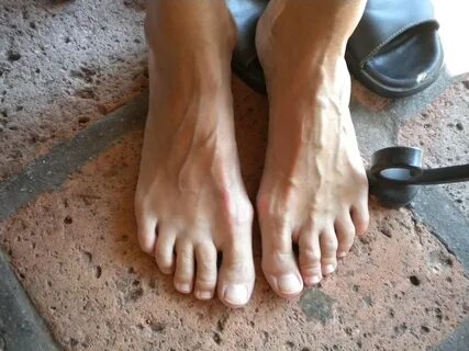 High arched feet