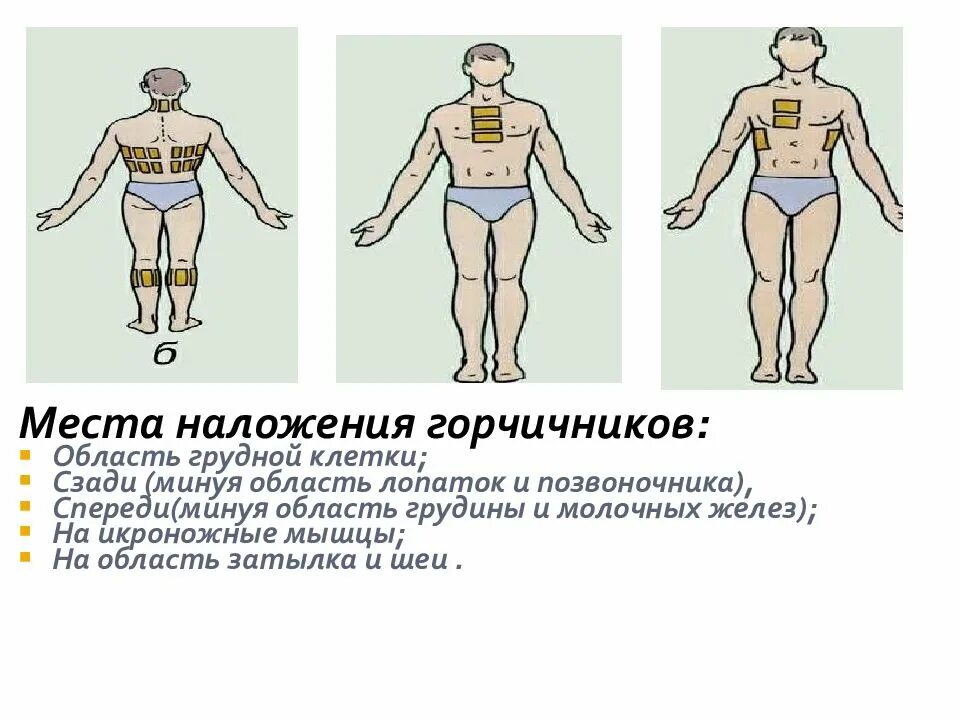 Можно ли ставить ребенку горчичники при кашле. Место накладывания горчичников. горчичники схема наложения. места постановки горчичников.