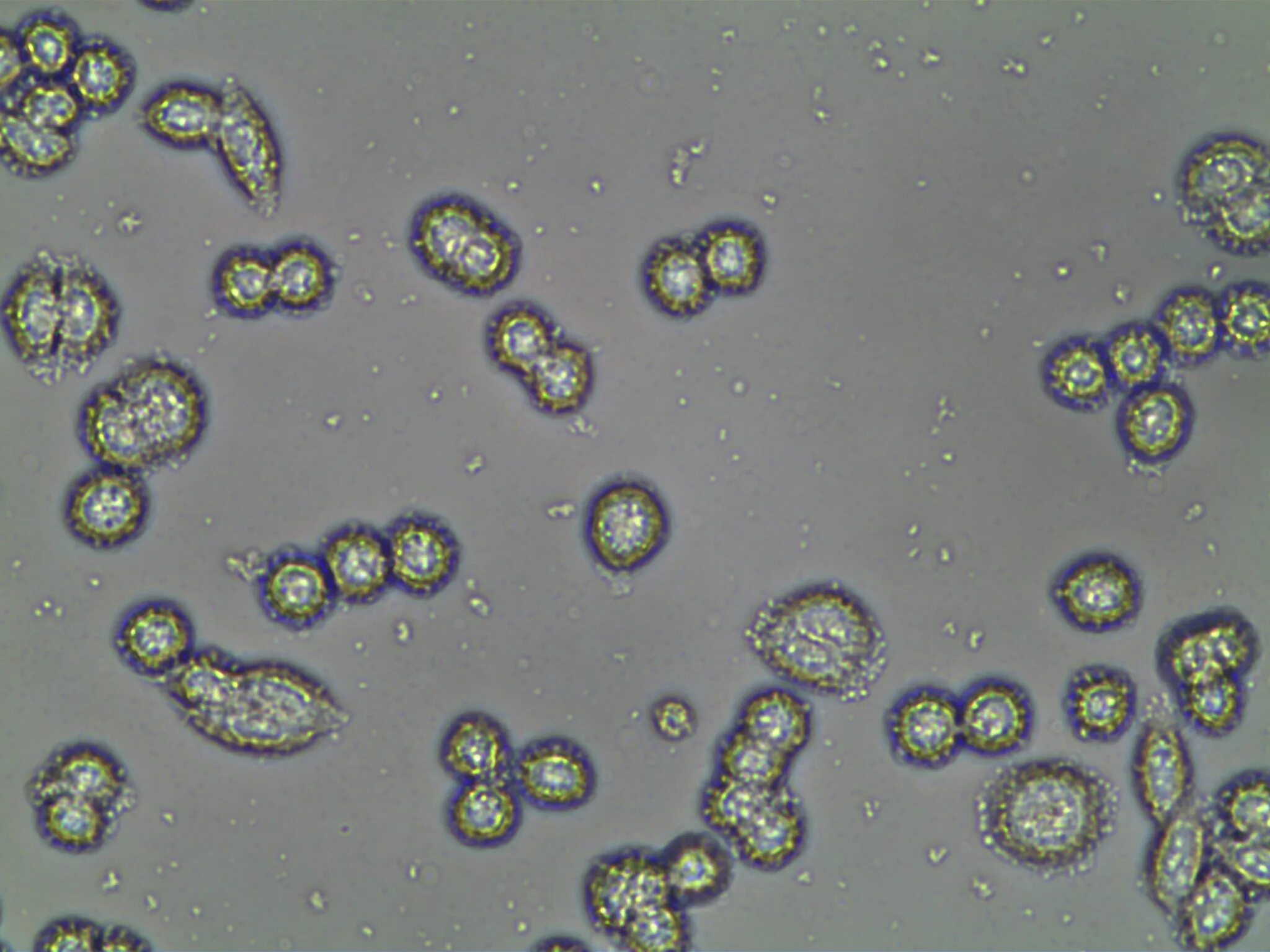 Дрожжи живые организмы. Дрожжи Saccharomyces cerevisiae. Дрожжей Saccharomyces cerevisiae микроскопия. Дрожжи Saccharomyces микроскопия. Пекарские дрожжи Saccharomyces cerevisiae.