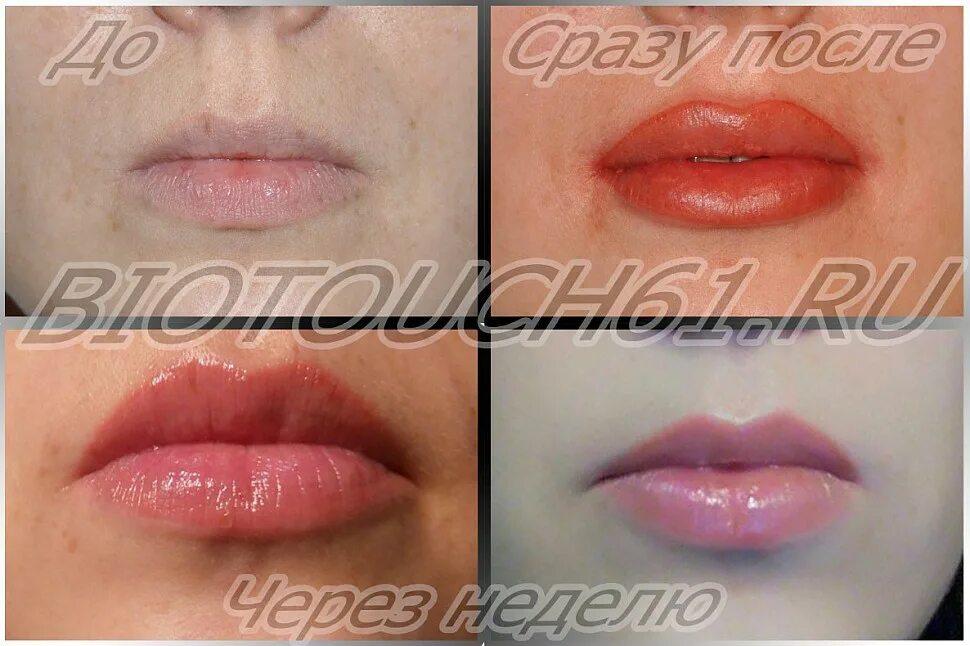 Перманентный макияж губ на узкие губы. Удаление перманентного макияжа губ ремувером. Татуаж губ. Некачественный татуаж губ. Татуаж губ.