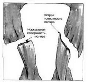 Волчки у лошади