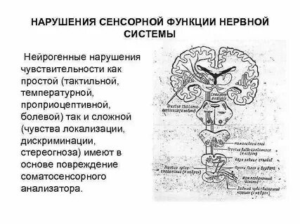 Нарушение сенсорной системы