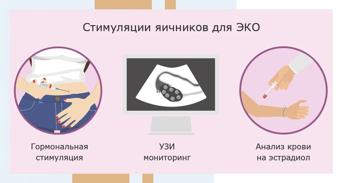 Эко подсадка на какой день цикла. Эко подсадка на какой день цикла