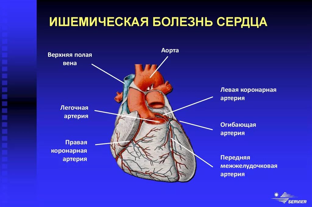 Коронарные венечные сосуды. Ишемическая болезнь сердца. Коронарные заболевания сердца. Сердца анатомия ишемия.