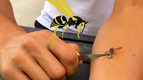 Сон укусила оса в руку