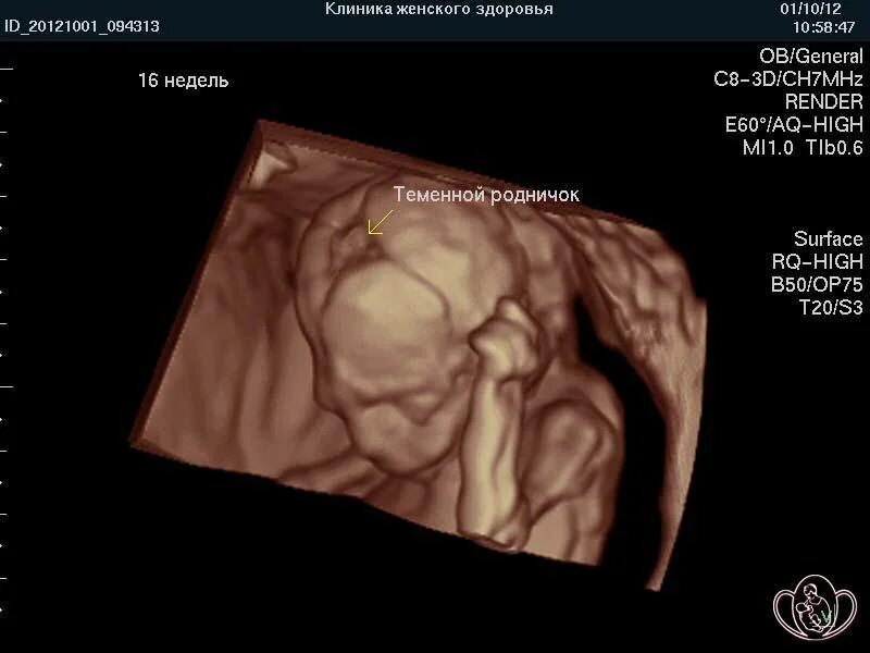 Плод 16 недель беременности УЗИ плода. 15-16 Недель беременности. УЗИ 16 недель беременности. 16 Недель беременности размер плода.