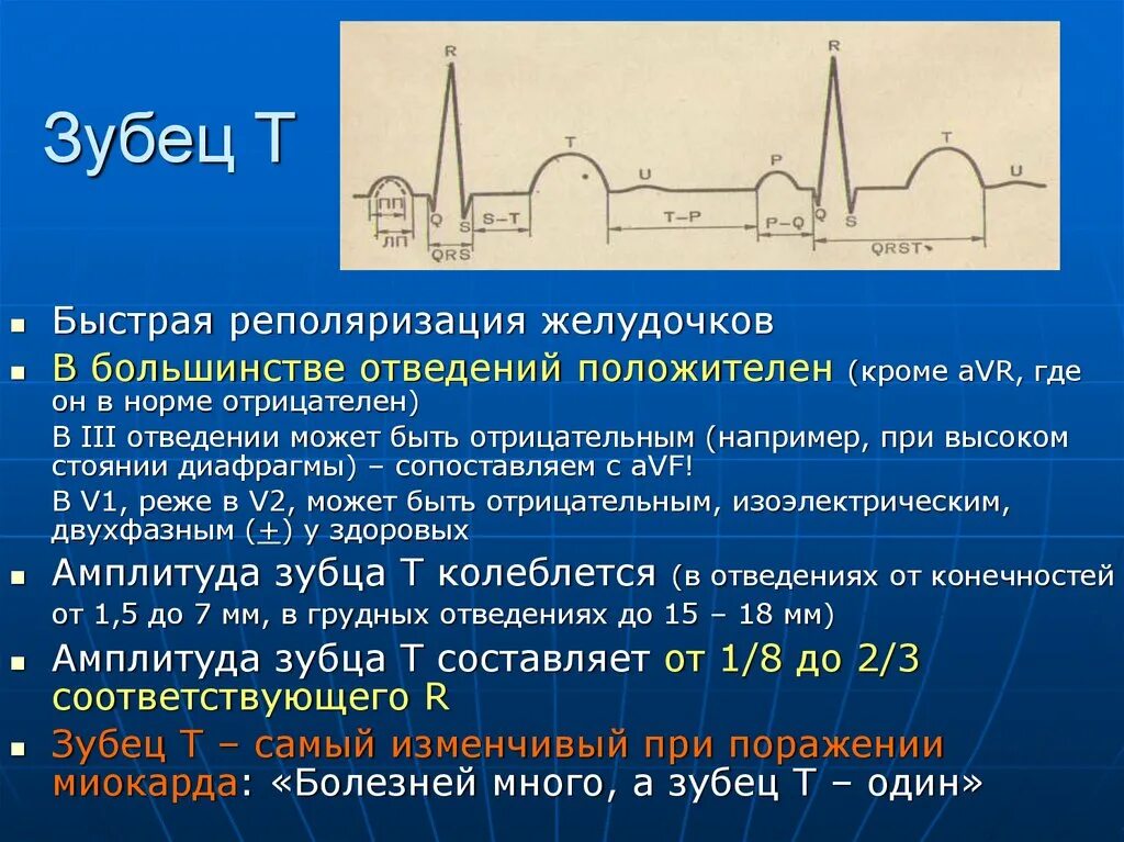 Отрицательный зубец т на ЭКГ В норме. Отрицательный зубец т во 2 отведении. Двугорбый зубец т на ЭКГ. Амплитуда зубца р в нормальной ЭКГ. Зубцы экг в норме