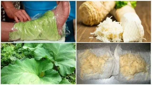 Капустный лист при артрозах. Компресс из капустного листа. компрессы с капустным листом для суставов. капустный лист для суставов для суставов.