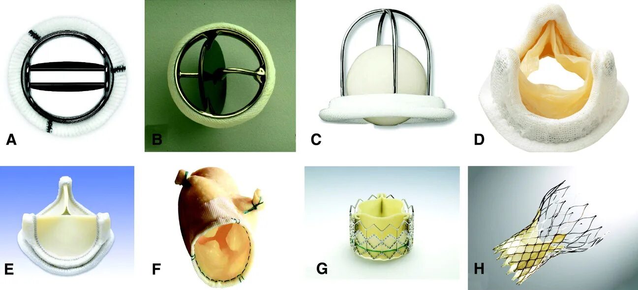 Искусственный аортальный клапан сердца. Искусственный механический клапан аортальный. Аортальный биологический клапан сердца. Протез аортального клапана механический двустворчатый.