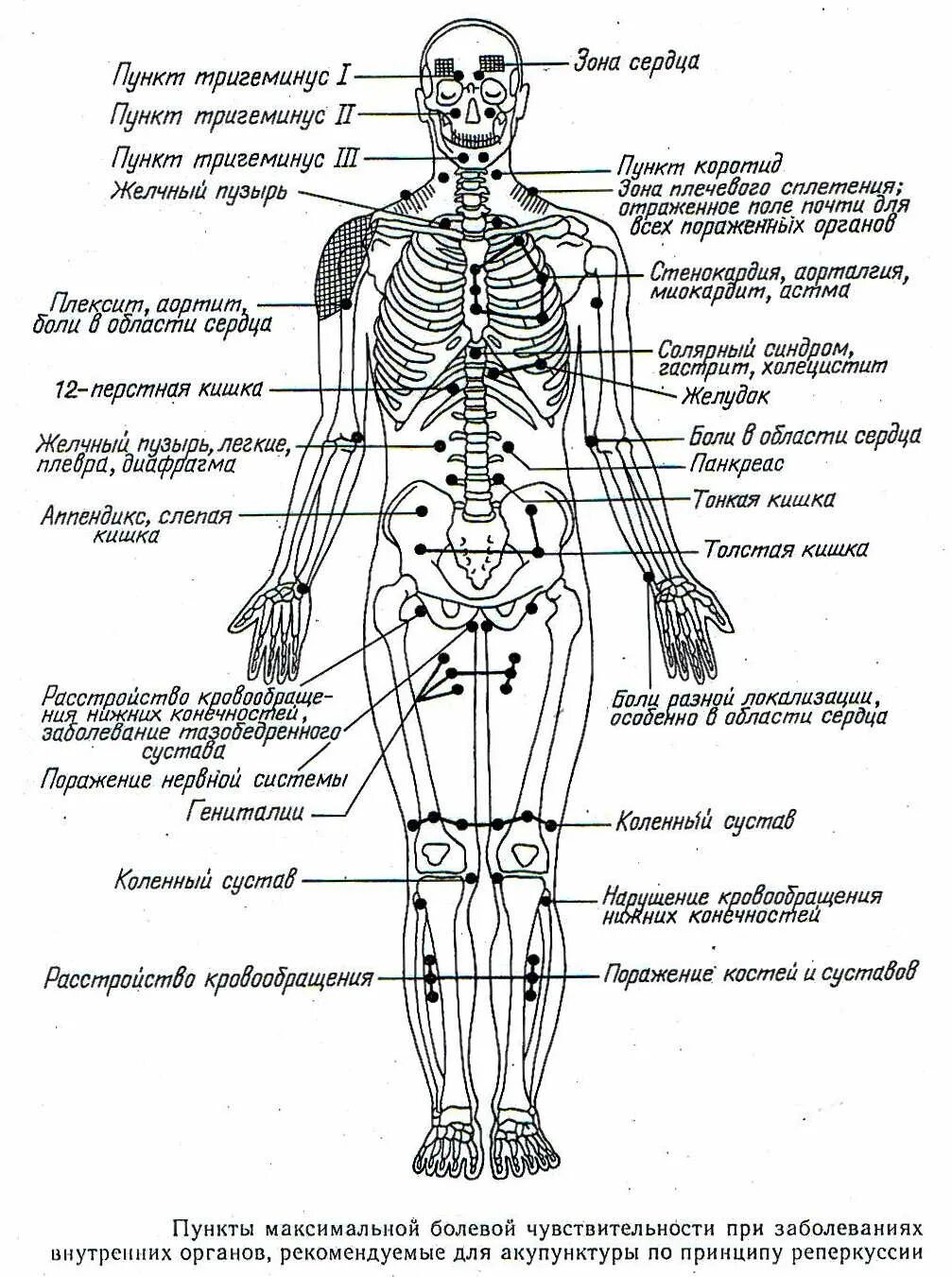 Названия точек человека. Болевые точки на теле человека отвечающие за органы. Болевые точки человека схема. Акупунктурные точки на теле человека схема. Акупунктура схема точек.