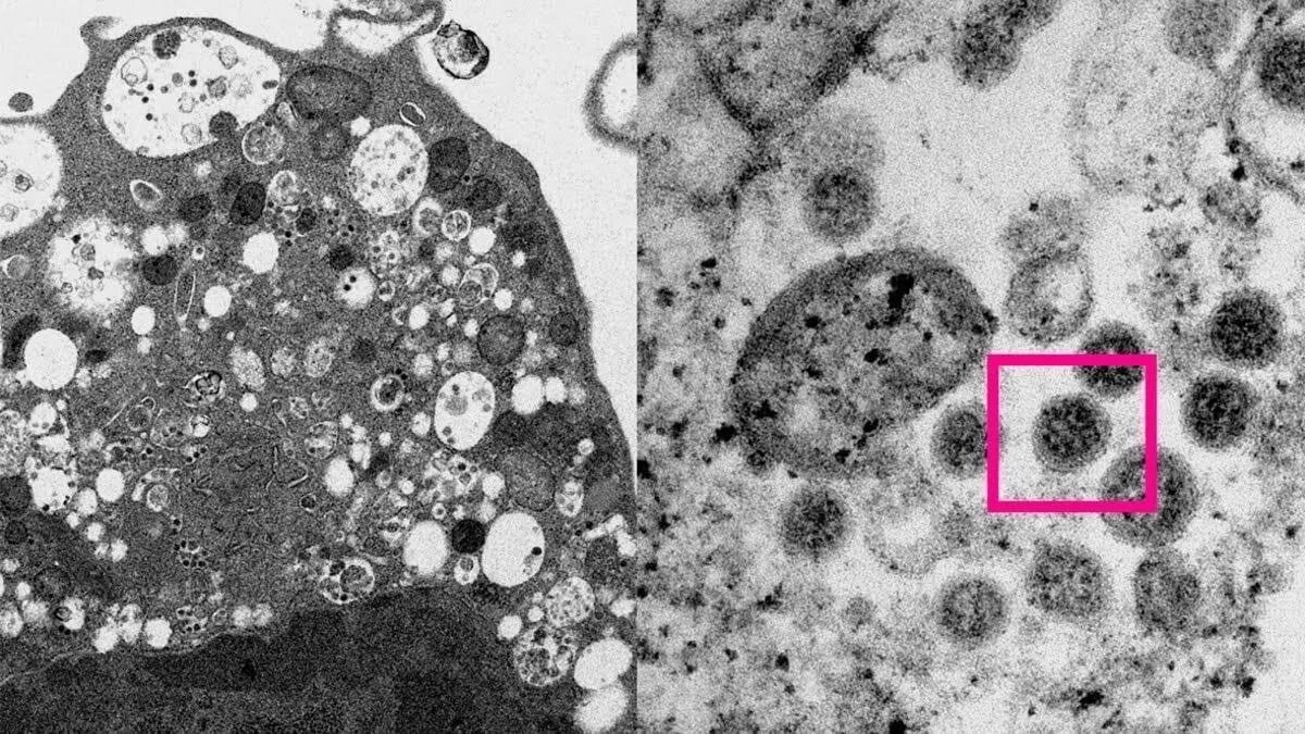Омикрон коронавирус. Вирусы под микроскопом. Штаммы коронавируса под микроскопом. Коронавирус штаммы омикрон